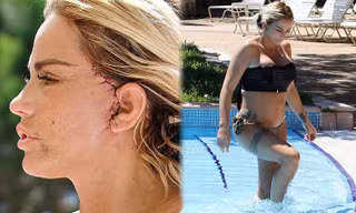 Katie Price mang mặt sẹo, bó căng ngực đi bơi hậu ‘đại tu’ ngoại hình