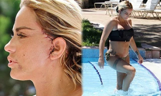 Katie Price mang mặt sẹo, bó căng ngực đi bơi hậu ‘đại tu’ ngoại hình