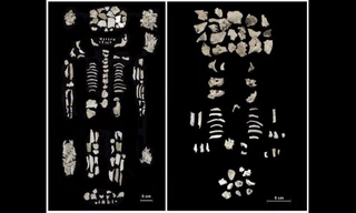 Bộ xương người mẹ ( bên trái) và cặp song sinh,