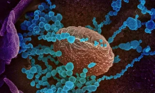 Virus SARS-CoV-2 ( màu xanh) được chụp qua kính hiển vi điện tử.