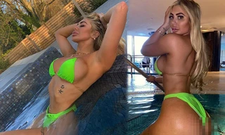 Vòng một bất thường của ‘mỹ nhân dao kéo’ Chloe Ferry
