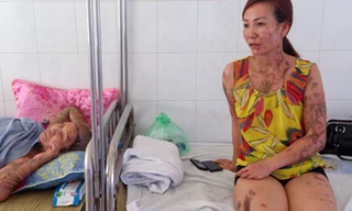 Hung thủ tạt axit 5 người khai gì tại cơ quan điều tra