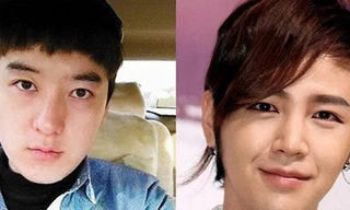 Phẫu thuật thẩm mỹ giống sao Hàn để… tưởng nhớ bạn gái