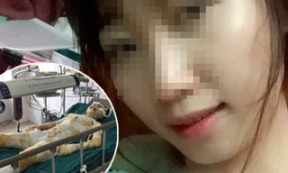 Chị H trước và sau khi bị tẩm xăng đốt.Ảnh: ANTĐ