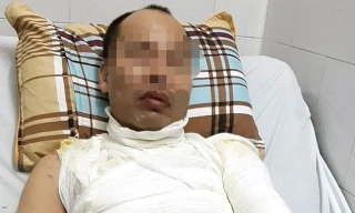 Anh H. điều trị tại bệnh viện.