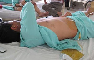 Vợ bạo hành chồng: Đòn độc của “phái yếu”