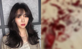 Mina (AOA) đăng ảnh cổ tay đầy máu, khẳng định: “Các người chẳng biết gì về tôi cả”