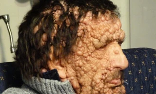 Anh Vinicio Riva, 53 tuổi