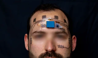 “Hình xăm điện tử” là một thiết bị nhẹ và không dây, linh hoạt hơn nhiều so với các công nghệ tương tự