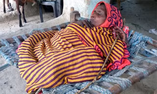 Chứng bệnh lạ khiến bà Shanti thường xuyên sống trong cảnh đau nhức toàn thân. Ảnh: Caters.