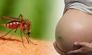 TPHCM: đã có 69 trường hợp nhiễm virus Zika