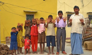 Kỳ lạ gia đình ai cũng có… 12 ngón tay, 12 ngón chân