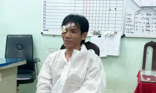 Bản tin 8H: Danh tính kẻ cầm kéo tấn công công an phường ở TP HCM