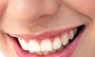 Vì sao chảy máu chân răng?