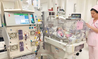 Lọc máu cứu sống bé sơ sinh nhiễm trùng huyết 