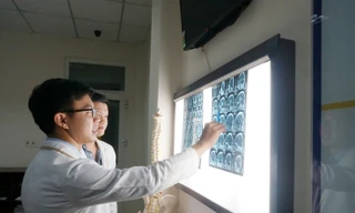 Chủ quan cụ bà suýt chết vì khối u khổng lồ trong não