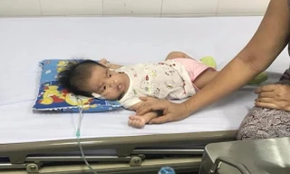 Hiện sức khoẻ bệnh nhi đã ổn định. 