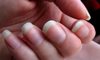 Móng tay có thể phát triển nhanh hơn so với móng chân tùy theo đặc điểm giới tính, chế độ ăn uống hay di truyền. (Ảnh minh họa: Flickr)