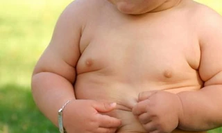 Béo phì dễ mắc 10 bệnh ung thư phổ biến
