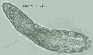 Phát hiện loài bọ ve siêu nhỏ trên mặt và đầu con người