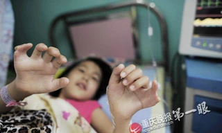 Bé gái có 15 ngón chân và 12 ngón tay