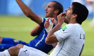 'Nạn nhân' Giorgio Chiellini nói gì về lời xin lỗi của Suarez?