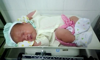 Cháu bé trai hiện đang được chăm sóc tại bệnh viện. Ảnh: B.T.