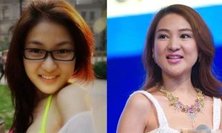 Chi 20.000 USD phẫu thuật mặt tròn thành... dài