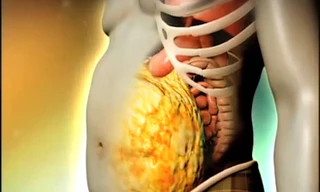 Mỡ trắng “thủ phạm” gây thừa cân, béo phì