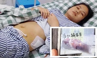 Cô Wai Jianmin nghi ngờ bệnh viện có liên quan tới đường dây buôn bán nội tạng. Ảnh: shanghaiist