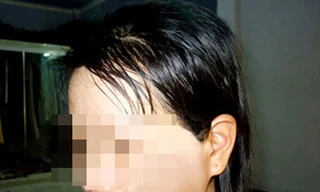 Xung quanh vụ bác sĩ bạo hành vợ ép ly hôn