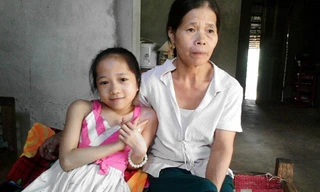 Cô bé xương thuỷ tinh giỏi toán