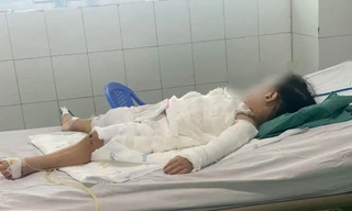 Uống nhầm nước tẩy bồn cầu, bé 2 tuổi bỏng nặng, bố bế cũng bị bỏng theo