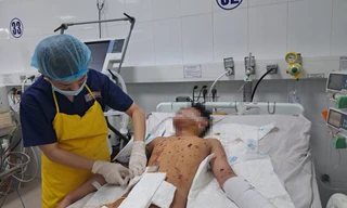 Chơi pháo, bé trai 12 tuổi vỡ ruột, nát tay