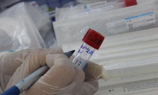 Sau 28 ngày cách ly, kỹ sư dầu khí phát hiện dương tính với SARS-CoV-2