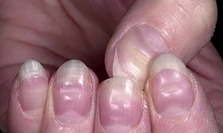 Ảnh minh hoạ: internet