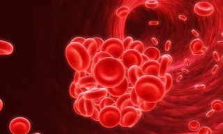 Ảnh minh họa: Internet