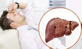 Ảnh minh hoạ: Internet