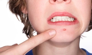 Ảnh minh hoạ: Internet