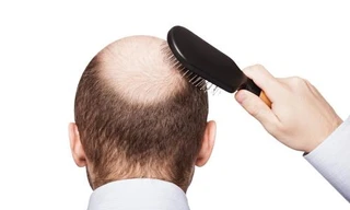 Ảnh minh họa: Internet