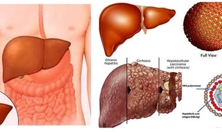 Ảnh minh hoạ: Internet