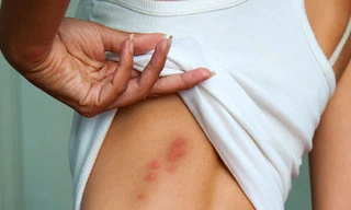 Ảnh minh hoạ: Internet