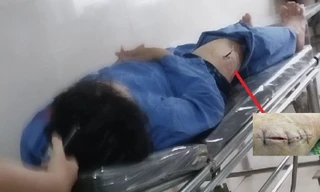 Cán bộ Cục Thuế Ninh Bình phản bác lời khai của kẻ dùng dao đâm mình 