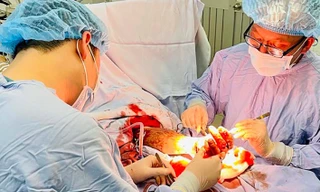 Ca mổ nối bàn tay cho anh N.Đ.P 