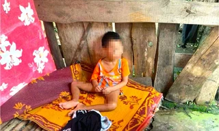 Bé 5 tuổi có nhiều vết thương bị đưa ra ở riêng trong lán tạm