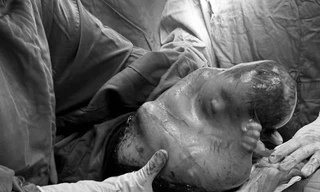 Hy hữu bé trai đẻ trong 'bọc điều may mắn' ngày đầu năm mới