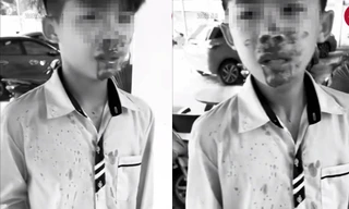 Hai học sinh mâu thuẫn, nam sinh lớp 7 bị bố bạn tát chảy máu mũi