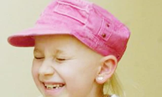 Bé gái cười liên tục ba tuần sau khi mổ não