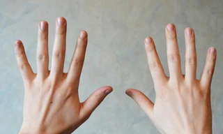 Nhìn móng tay để biết mình có bệnh hay không