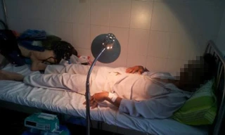 Tức tốc đưa chồng đi viện sau khi cắt lìa ‘của quý’